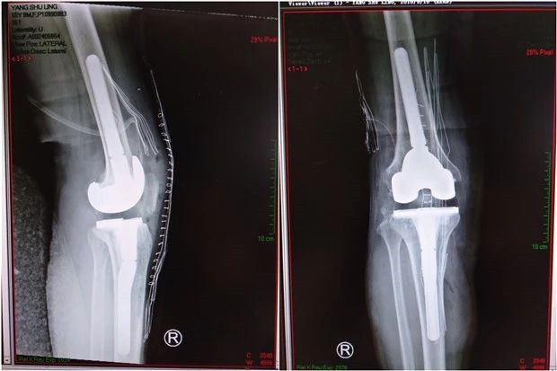 20190310_233322_605047.jpg 2222222.jpg