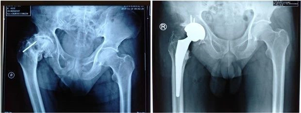 20190310_233343_782371.jpg 3333333.jpg